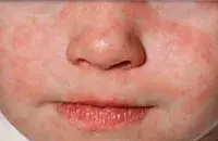 Фото: epidemiolog.ru